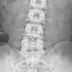 X-Rays